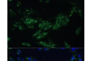 Immunofluorescence analysis of C6 cells using EPHA4 Polyclonal Antibody at dilution of 1:100. (EPH Receptor A4 antibody)