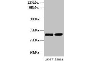 Western blot All lanes: UQCRQ antibody at 2 μg/mL Lane 1: EC109 whole cell lysate Lane 2: 293T whole cell lysate Secondary Goat polyclonal to rabbit IgG at 1/15000 dilution Predicted band size: 10 kDa Observed band size: 30 kDa (UQCRQ antibody  (AA 2-78))