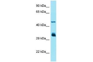 Western Blotting (WB) image for anti-Interferon-Induced Protein with Tetratricopeptide Repeats 1 (IFIT1) (Middle Region) antibody (ABIN2490346) (IFIT1 antibody  (Middle Region))