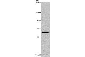 Western blot analysis of Hela cell, using IVL Polyclonal Antibody at dilution of 1:200 (Involucrin antibody)