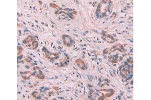 Used in DAB staining on fromalin fixed paraffin- embedded Kidney tissue (MYL6 antibody  (AA 4-146))