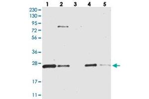 Western blot analysis of Lane 1: RT-4, Lane 2: U-251 MG, Lane 3: Human Plasma, Lane 4: Liver, Lane 5: Tonsil with CCDC90B polyclonal antibody  at 1:250-1:500 dilution. (CCDC90B antibody)