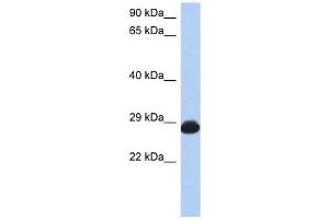 RAB39B antibody used at 1 ug/ml to detect target protein. (RAB39B antibody  (N-Term))