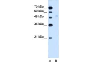 Western Blotting (WB) image for anti-Solute Carrier Family 2 (Facilitated Glucose Transporter), Member 6 (SLC2A6) antibody (ABIN2462758) (SLC2A6 antibody)
