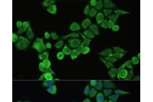 Immunofluorescence analysis of HeLa cells using Fibronectin Polyclonal Antibody at dilution of 1:100. (Fibronectin antibody)