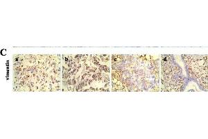 Immunohistochemistry (IHC) image for anti-Vimentin (VIM) (AA 371-466) antibody (ABIN672786)