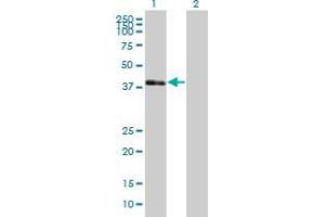 Western Blot analysis of POU3F4 expression in transfected 293T cell line ( H00005456-T01 ) by POU3F4 MaxPab polyclonal antibody. (POU3F4 antibody  (AA 1-361))