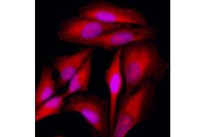 Immunofluorescence of HeLa cells stained with Hoechst 3342 (Blue) for nucleus staining and monoclonal anti-human KRT18 antibody (1:500) with Texas Red (Red). (Cytokeratin 18 antibody  (AA 79-430))