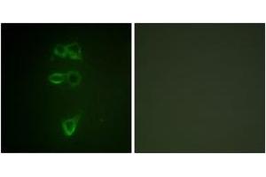 Immunofluorescence analysis of HepG2 cells, using TIE2 (Phospho-Tyr1108) Antibody. (TEK antibody  (pTyr1108))