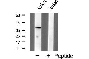 Western blot analysis of MKP1 expression in Jurkat cell extracts (DUSP1 antibody  (C-Term))
