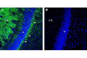 Expression of P2RY1 in rat hippocampus.