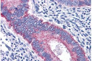 Human Uterus: Formalin-Fixed, Paraffin-Embedded (FFPE) (BAIAP2L1 antibody  (AA 398-512))