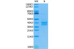 Cynomolgus EpCAM on Tris-Bis PAGE under reduced condition. (EpCAM Protein (AA 24-265) (His tag))