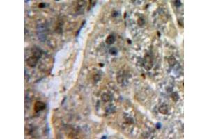 Used in DAB staining on fromalin fixed paraffin-embedded Liver tissue (SP100 antibody  (AA 261-465))