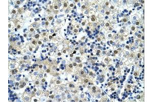 NFYC antibody was used for immunohistochemistry at a concentration of 4-8 ug/ml. (NFYC antibody  (C-Term))