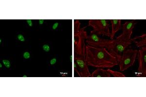 ICC/IF Image ADAR1 antibody [N3C1], Internal detects ADAR1 protein at nucleolus and nucleus by immunofluorescent analysis.