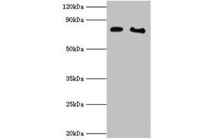 Western blot All lanes: POR antibody at 2 μg/mL Lane 1: K562 whole cell lysate Lane 2: A431 whole cell lysate Secondary Goat polyclonal to rabbit IgG at 1/10000 dilution Predicted band size: 77 kDa Observed band size: 77 kDa (POR antibody  (AA 2-671))