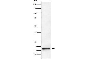 Western blot analysis of AP2S1 expression in HeLa cell lysate.
