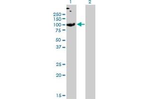 Western Blot analysis of SLC26A2 expression in transfected 293T cell line by SLC26A2 monoclonal antibody (M04), clone 3F6. (SLC26A2 antibody  (AA 1-108))