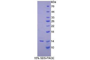 SDS-PAGE analysis of Human Inhibin beta C Protein.
