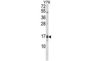Western blot analysis of GADD45A Antibody (C-term) in Y79 cell line lysates (35ug/lane).