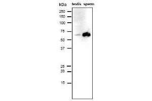 Western Blotting (WB) image for anti-Izumo Sperm-Egg Fusion 1 (IZUMO1) antibody (ABIN2452040) (IZUMO1 antibody)