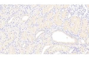 Detection of Lpa in Human Kidney Tissue using Polyclonal Antibody to Lipoprotein, a (Lpa) (Lp(a) antibody  (AA 1719-2038))