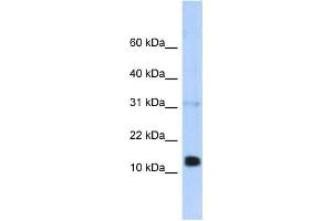 Western Blotting (WB) image for anti-Regenerating Islet-Derived 1 beta (REG1B) antibody (ABIN2458063) (REG1B antibody)