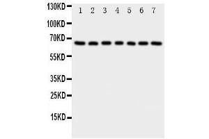 Western Blotting (WB) image for anti-NADPH Oxidase 4 (NOX4) (AA 561-578), (C-Term) antibody (ABIN3044011) (NADPH Oxidase 4 antibody  (C-Term))