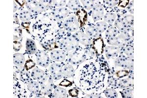 IHC-P: AQP2 antibody testing of rat kidney tissue (AQP2 antibody  (AA 245-260))