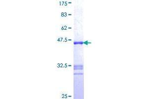 AGTPBP1 Protein (AA 1087-1186) (GST tag)