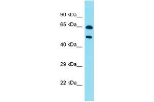 Host:  Rabbit  Target Name:  PAX8  Sample Type:  Pancreas Tumor lysates  Antibody Dilution:  1. (PAX8 antibody  (C-Term))