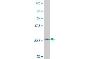 Western Blot detection against Immunogen (37. (HIPK1 antibody  (AA 330-430))