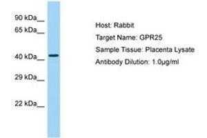 Image no. 1 for anti-G Protein-Coupled Receptor 25 (GPR25) (AA 166-215) antibody (ABIN6750185) (GPR25 antibody  (AA 166-215))