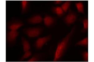 Image no. 1 for anti-GATA Binding Protein 1 (Globin Transcription Factor 1) (GATA1) (pSer310) antibody (ABIN196686) (GATA1 antibody  (pSer310))