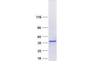 Validation with Western Blot (ZFAND2B Protein (Myc-DYKDDDDK Tag))