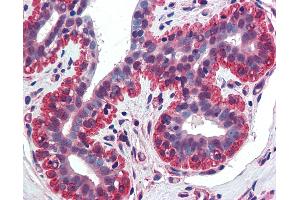 Anti-APRIL antibody IHC of human breast.