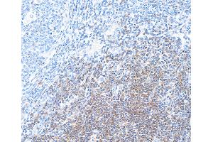 Immunohistochemistry (IHC) image for anti-CD28 (CD28) (AA 19-140) antibody (ABIN7448899)