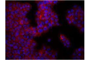 Immunofluorescence (IF) image for anti-Integrin beta 1 (ITGB1) antibody (ABIN2664519) (ITGB1 antibody)