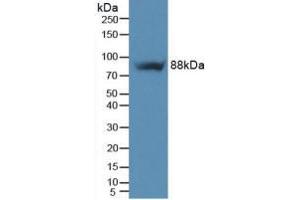 Figure. (Integrin beta 5 antibody  (AA 137-378))