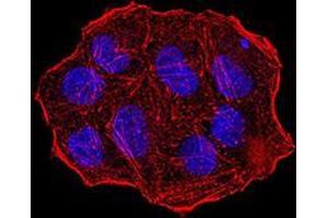 Immunocytochemistry (ICC) image for anti-Ubiquitin-Like, Containing PHD and RING Finger Domains, 1 (UHRF1) (AA 616-755) antibody (ABIN5542545)
