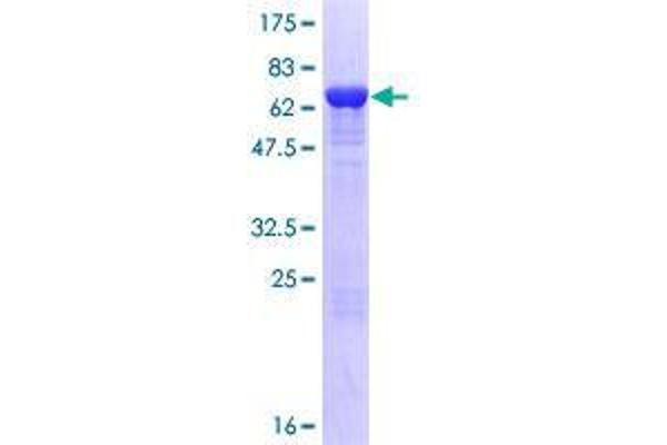 TBC1D13 Protein (AA 1-400) (GST tag)