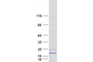 Validation with Western Blot