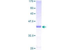 CDA Protein (AA 1-146) (GST tag)