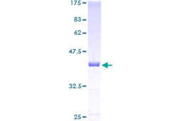 CDA Protein (AA 1-146) (GST tag)