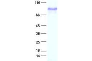 Validation with Western Blot