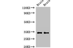 Western Blot Positive WB detected in: Mouse brain tissue, Rat brain tissue All lanes: NPY6R antibody at 2. (NPY6R antibody  (AA 1-39))