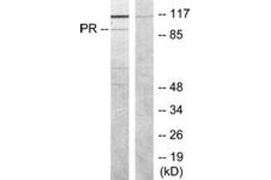 Western blot analysis of extracts from COS7 cells, treated with EGF, using Progesterone Receptor (Ab-190) Antibody. (Progesterone Receptor antibody  (AA 161-210))