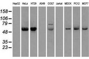 Western blot analysis of extracts (35 µg) from 9 different cell lines by using anti-CHEK2 monoclonal antibody. (CHEK2 antibody)