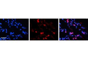Immunohistochemistry (IHC) image for anti-Transketolase (TKT) (N-Term) antibody (ABIN2783411)